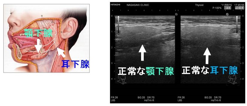 正常な顎下腺・耳下腺 正常な顎下腺・耳下腺