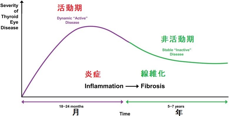 活動性・非活動性バセドウ病眼症(甲状腺眼症) 活動性・非活動性バセドウ病眼症(甲状腺眼症)2