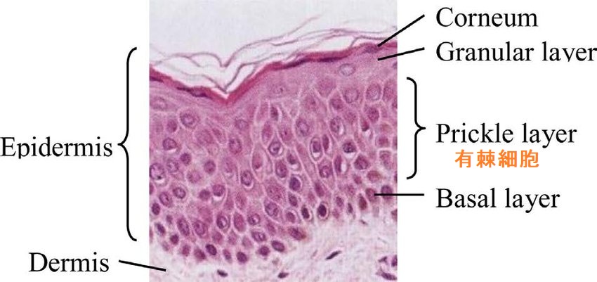 有棘細胞 有棘細胞