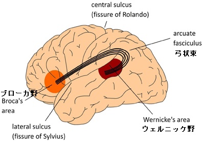 ウェルニッケ失語 ウェルニッケ失語