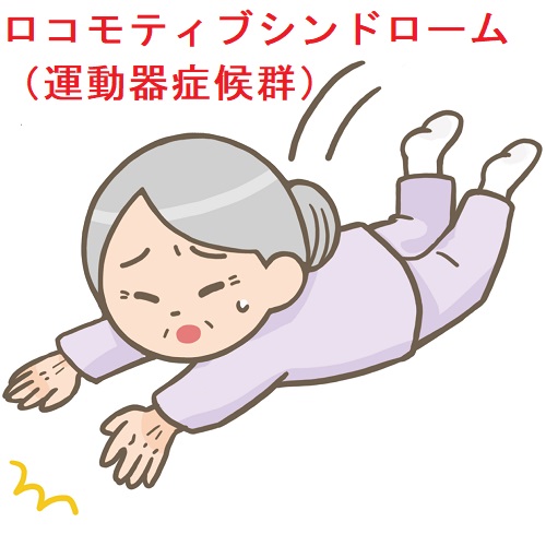 ロコモティブシンドローム(運動器症候群) ロコモティブシンドローム(運動器症候群)