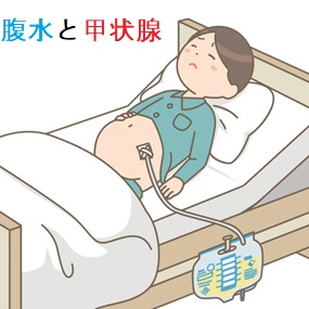 腹水と甲状腺 腹水と甲状腺