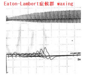Eaton-Lambert症候群 Eaton-Lambert症候群