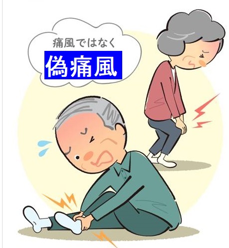 偽痛風 偽痛風