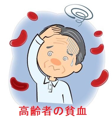 高齢者の貧血 高齢者の貧血