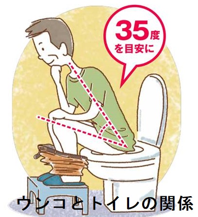 ウンコとトイレの関係 ウンコとトイレの関係
