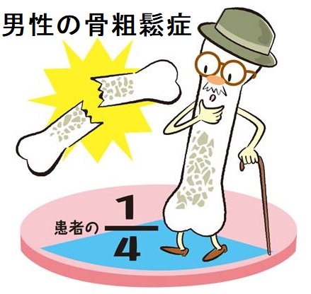 男性の骨粗しょう症 男性の骨粗しょう症