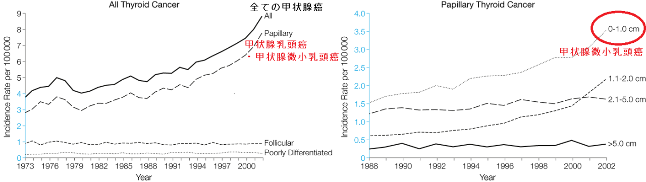 甲状腺乳頭癌・甲状腺微小乳頭癌の増加 甲状腺乳頭癌・甲状腺微小乳頭癌の増加