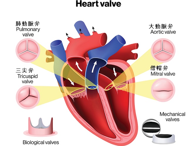 心臓弁膜症 心臓弁膜症