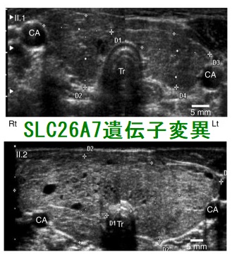 SLC26A7遺伝子変異 超音波(エコー)画像 SLC26A7遺伝子変異 超音波(エコー)画像