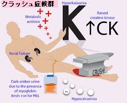 クラッシュ症候群 クラッシュ症候群