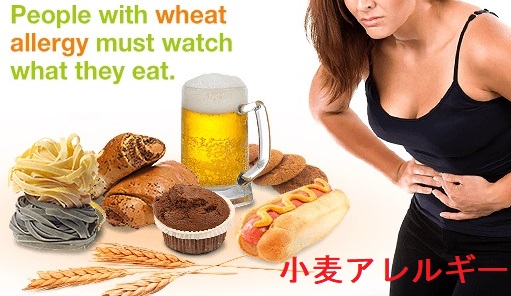 小麦アレルギーで甲状腺機能亢進症/バセドウ病が悪化 小麦アレルギーで甲状腺機能亢進症/バセドウ病が悪化