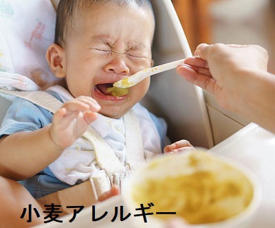 小麦アレルギー 小麦アレルギー