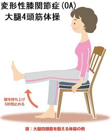 変形性関節症(OA) 大腿4頭筋体操 変形性関節症(OA) 大腿4頭筋体操