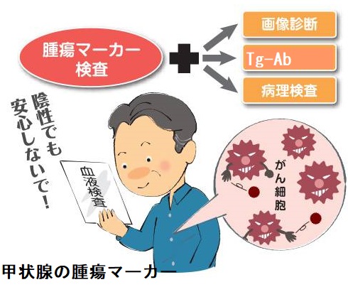 甲状腺の腫瘍マーカー 甲状腺の腫瘍マーカー