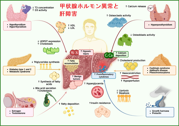 甲状腺と肝障害,コリンエステラーゼ,肝酵素,ALT[橋本病 バセドウ病
