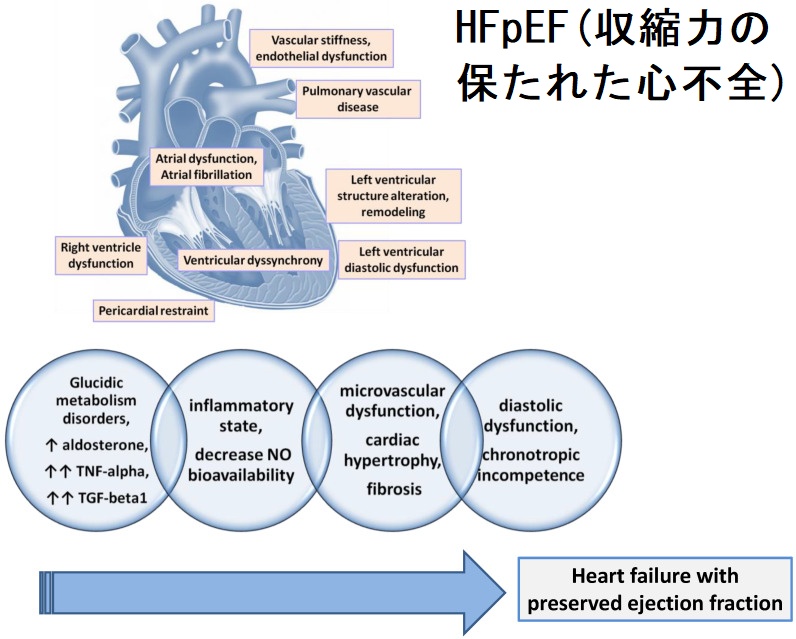HFpEF(収縮力の保たれた心不全) HFpEF(収縮力の保たれた心不全)