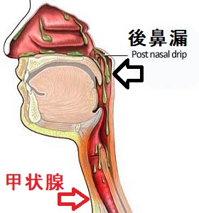 甲状腺と鼻・副鼻腔(鼻血,副鼻腔炎/蓄膿,後鼻漏) 甲状腺と鼻・副鼻腔(鼻血,副鼻腔炎/蓄膿,後鼻漏)