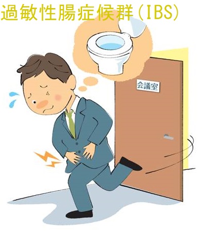 過敏性腸症候群(IBS) 過敏性腸症候群(IBS)