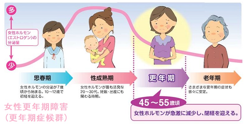 女性更年期障害(更年期症候群) 女性更年期障害(更年期症候群)