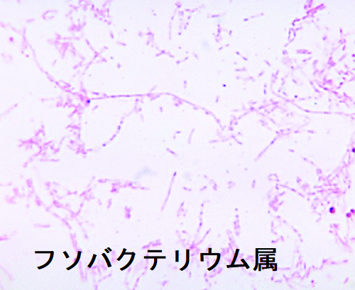 フソバクテリウム属 フソバクテリウム属