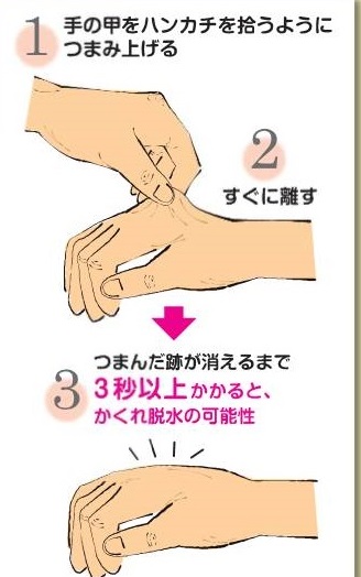 簡単な隠れ脱水のチェック法 簡単な隠れ脱水のチェック法
