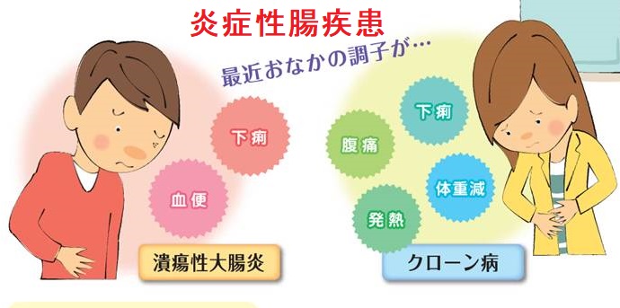 炎症性腸疾患 炎症性腸疾患