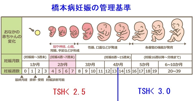 橋本病妊娠のい管理基準 橋本病妊娠のい管理基準