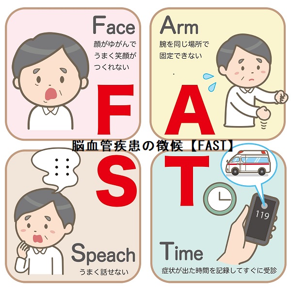 脳血管障害の徴候(FAST) 脳血管障害の徴候(FAST)