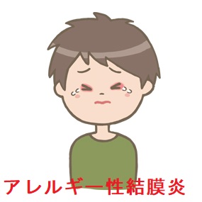アレルギー性結膜炎と甲状腺 2 アレルギー性結膜炎と甲状腺 2