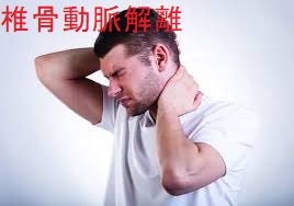 椎骨動脈解離 椎骨動脈解離