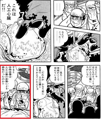 本間血腫 本間血腫
