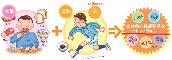 食物依存性運動誘発アナフィラキシー 食物依存性運動誘発アナフィラキシー