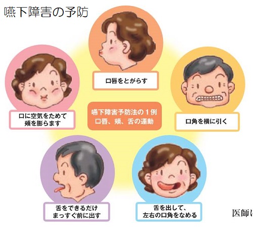 嚥下障害の予防 嚥下障害の予防
