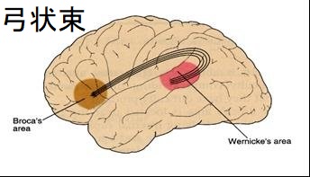 弓状束 弓状束