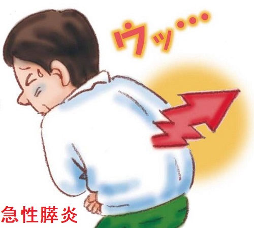 急性膵炎 急性膵炎