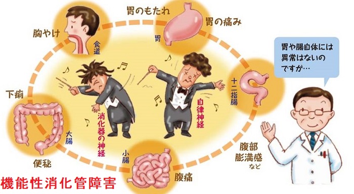 機能性消化管障害 機能性消化管障害