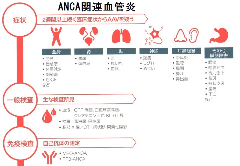 MPO-ANCA関連血管炎の症状 MPO-ANCA関連血管炎の症状