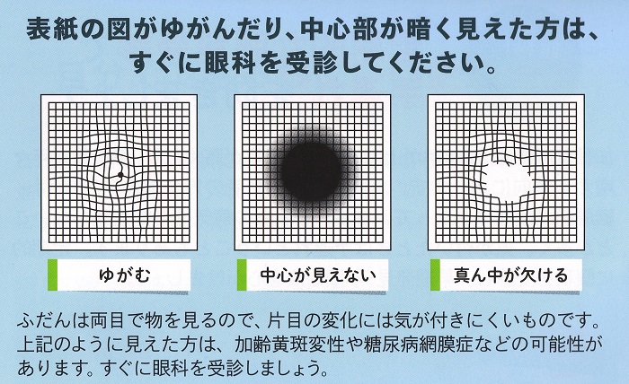 加齢黄斑変性症 アムスラーチャート 加齢黄斑変性症 アムスラーチャート