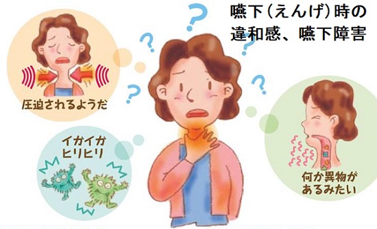 嚥下(えんげ)時の違和感、嚥下障害 嚥下(えんげ)時の違和感、嚥下障害