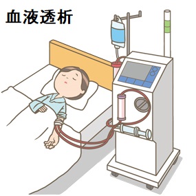 血液透析患者の心房細動(Af) 血液透析患者の心房細動(Af)