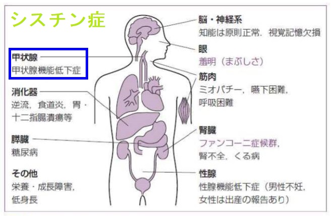シスチン症と甲状腺 シスチン症と甲状腺