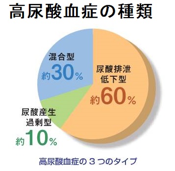 高尿酸血症の原因 高尿酸血症の原因