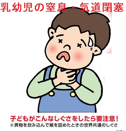 乳幼児の窒息・気道閉塞 乳幼児の窒息・気道閉塞