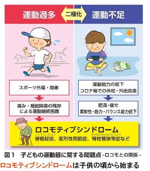 ロコモティブシンドロームは子供の頃から始まる ロコモティブシンドロームは子供の頃から始まる