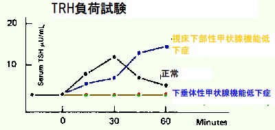 TRH負荷試験 TRH負荷試験