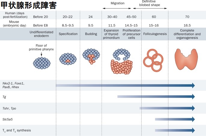 甲状腺形成障害 甲状腺形成障害