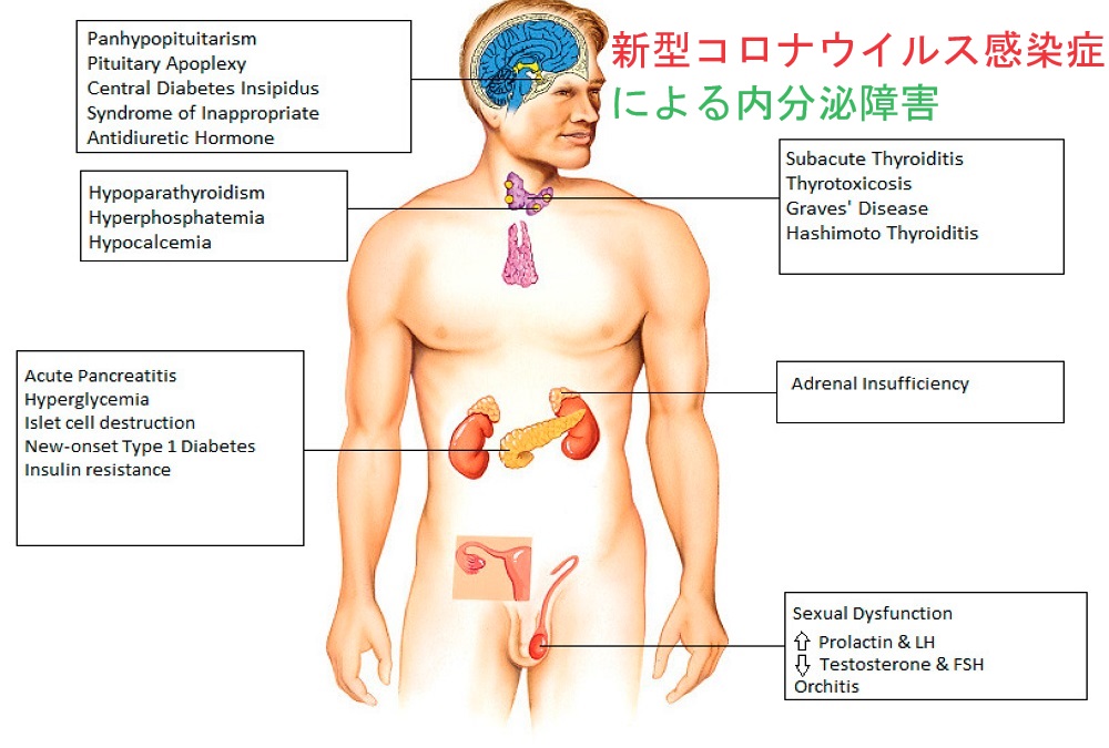 新型コロナウイルス感染症による内分泌障害 新型コロナウイルス感染症による内分泌障害