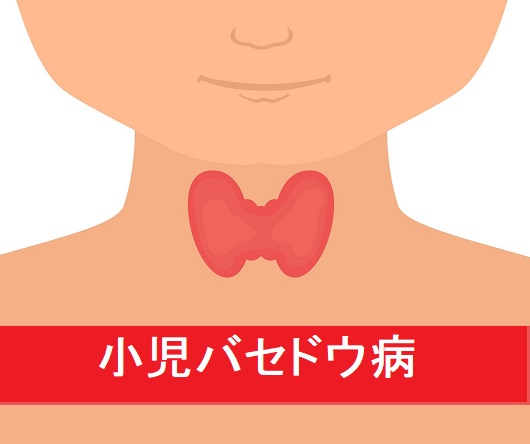 小児バセドウ病の治療 小児バセドウ病の治療