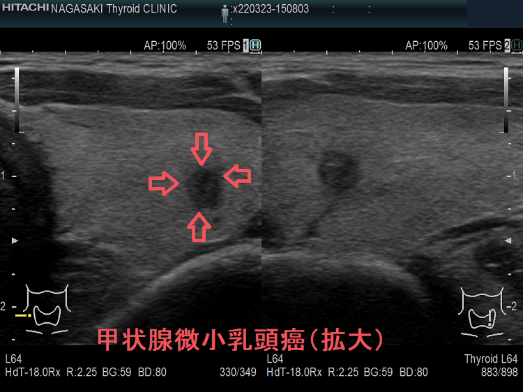 表在エコーの実学─乳腺・甲状腺・その他─ | 杉山 高 |本